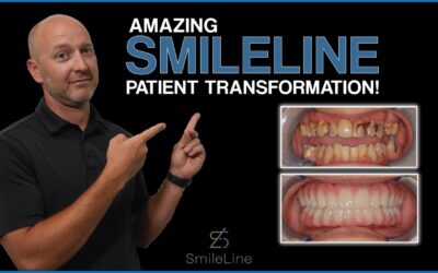 SmileLine Ep 12 – SmileLine Patient Transformation, Upper and Lower Prosthetic!