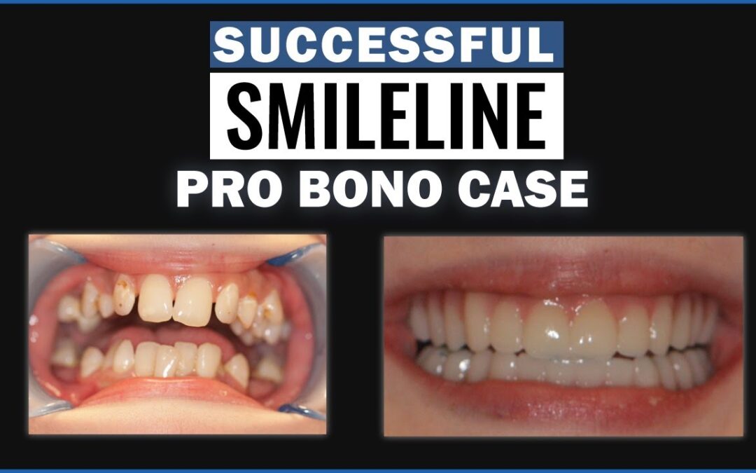 SmileLine Ep. 17 | A Challenging and Successful Pro Bono Case!
