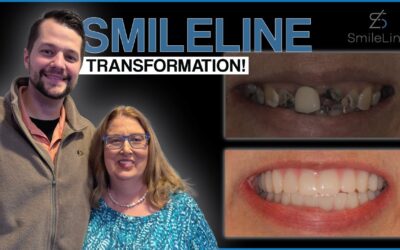 SmileLine Ep. 16 – Partials to Dentures into a BRAND NEW SmileLine