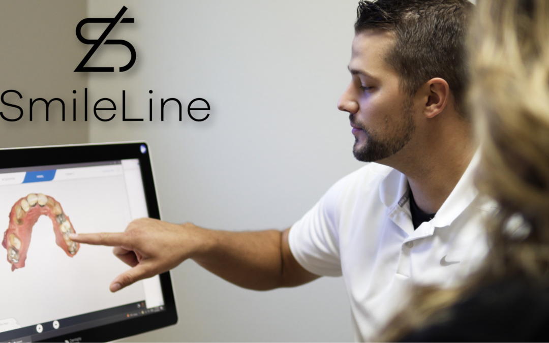 Best Candidates for Dental Implants in Mid‑Missouri